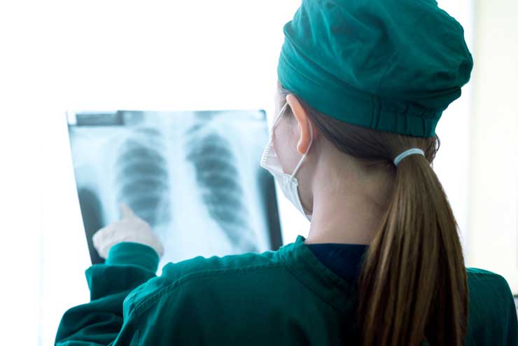 Doctor examines lung x-ray