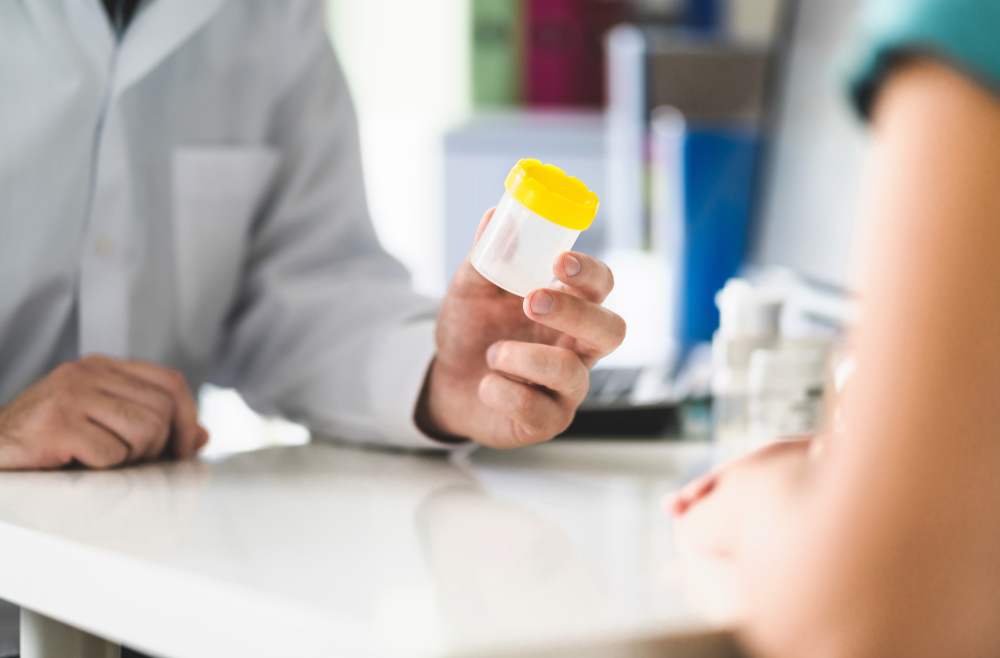 Drug test for cannabis